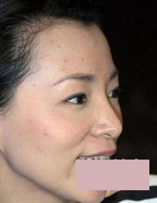 明星有皮肤病,明星护肤背后的皮肤病故事