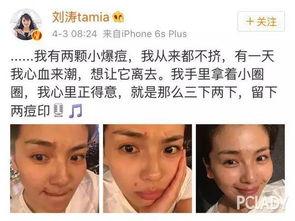 挤痘痘自拍表情包,捕捉青春印记的瞬间